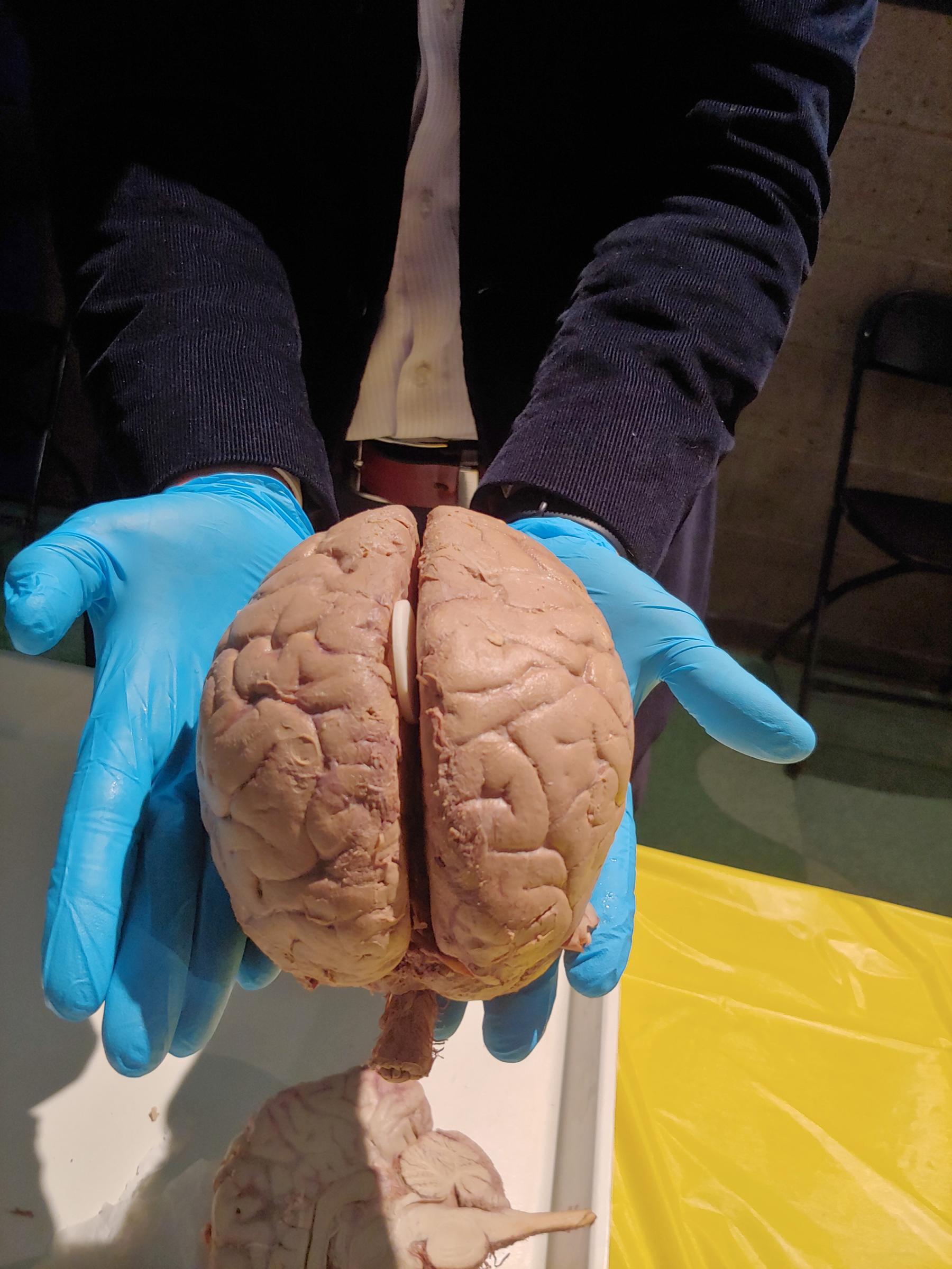 Human brain.